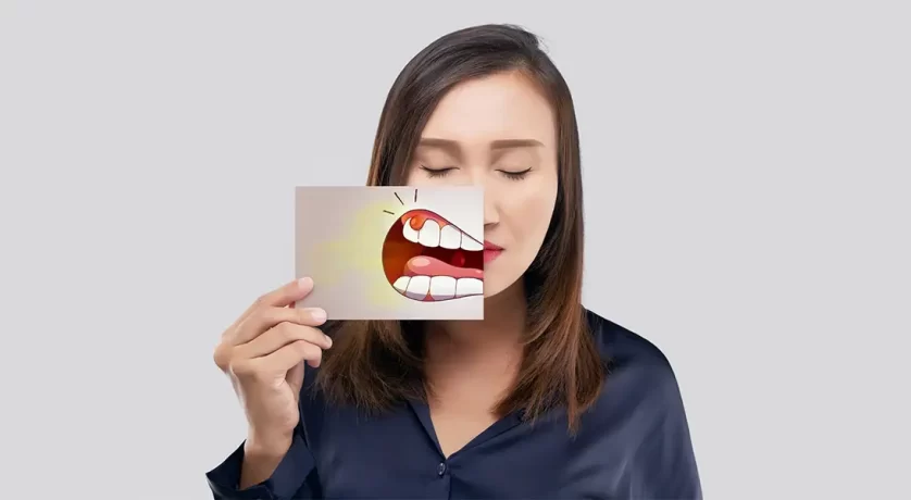 How Long Does Bleeding Last After Tooth Extraction
